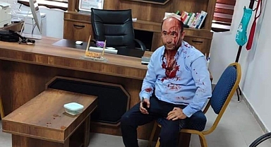 Şanlıurfa - Akçakale'de okul müdürü saldırıya uğradı