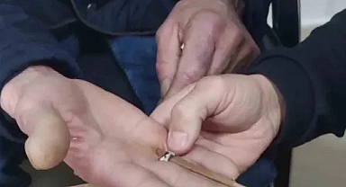 Şanlıurfa'da bir kişinin parmağına sıkışan yüzüğü itfaiye ekipleri çıkardı